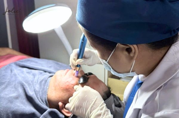 LOOKING FOR THE BEST ACNE TREATMENT IN PHILIPPINES? READ ON!