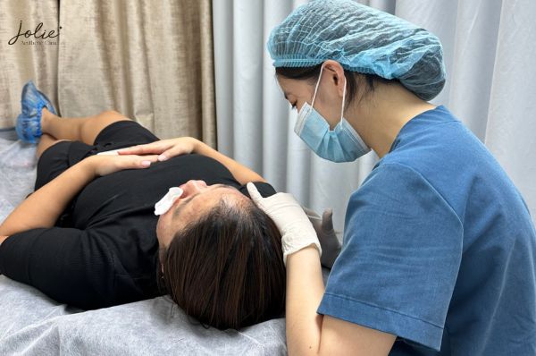 FILLER INJECTIONS FOR SCARS: WHAT YOU NEED TO KNOW