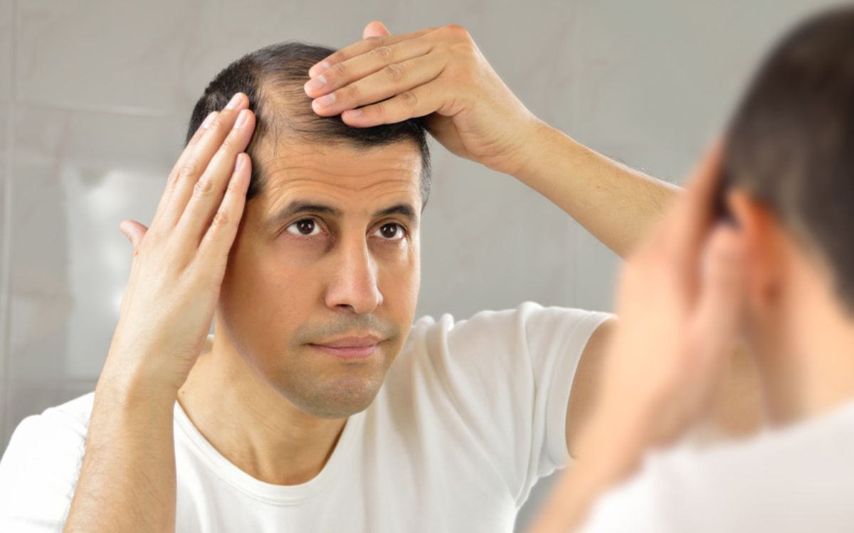 Hair Loss & Baldness Treatment