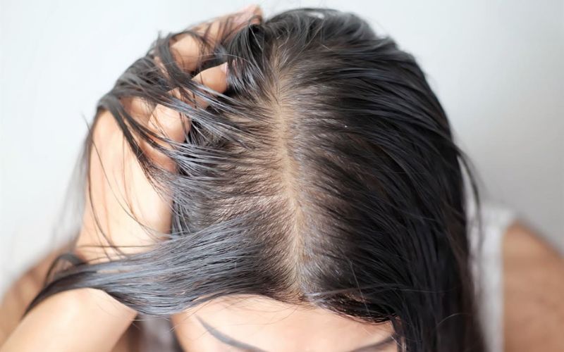 Treatment for Scalp Disorders